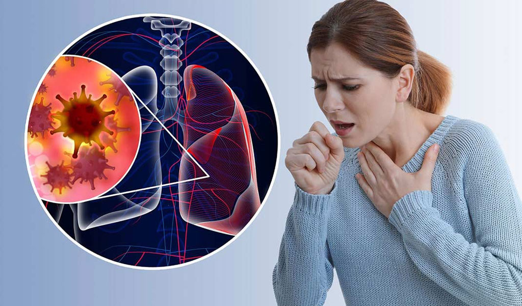 Dấu hiệu và triệu chứng của ung thư phổi