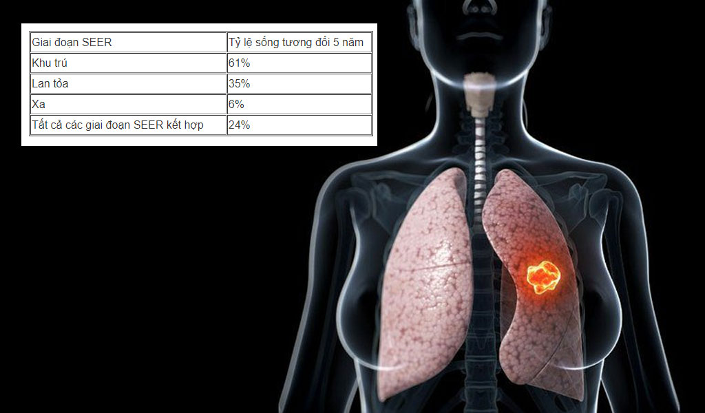 Tỷ lệ sống sót ung thư phổi