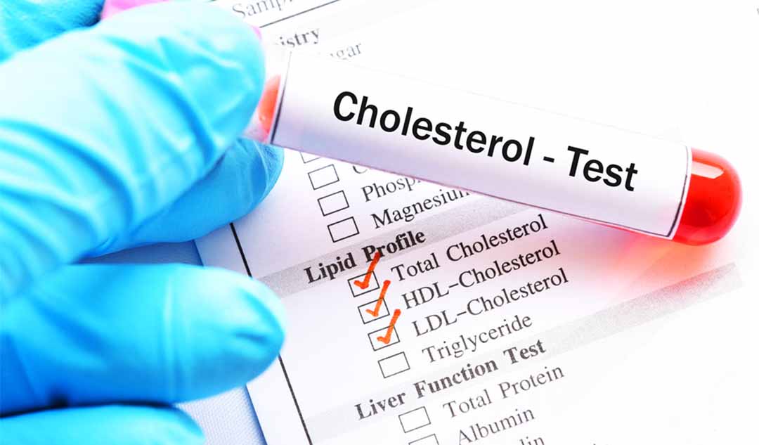 Làm thế nào để biết nếu bạn có cholesterol ở mức giới hạn?