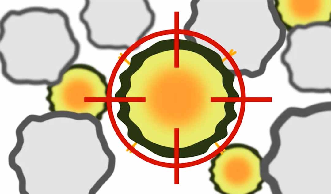 Liệu pháp nhắm trúng đích cho bệnh bạch cầu lymphoblastic cấp tính (ALL) có liên quan gì?