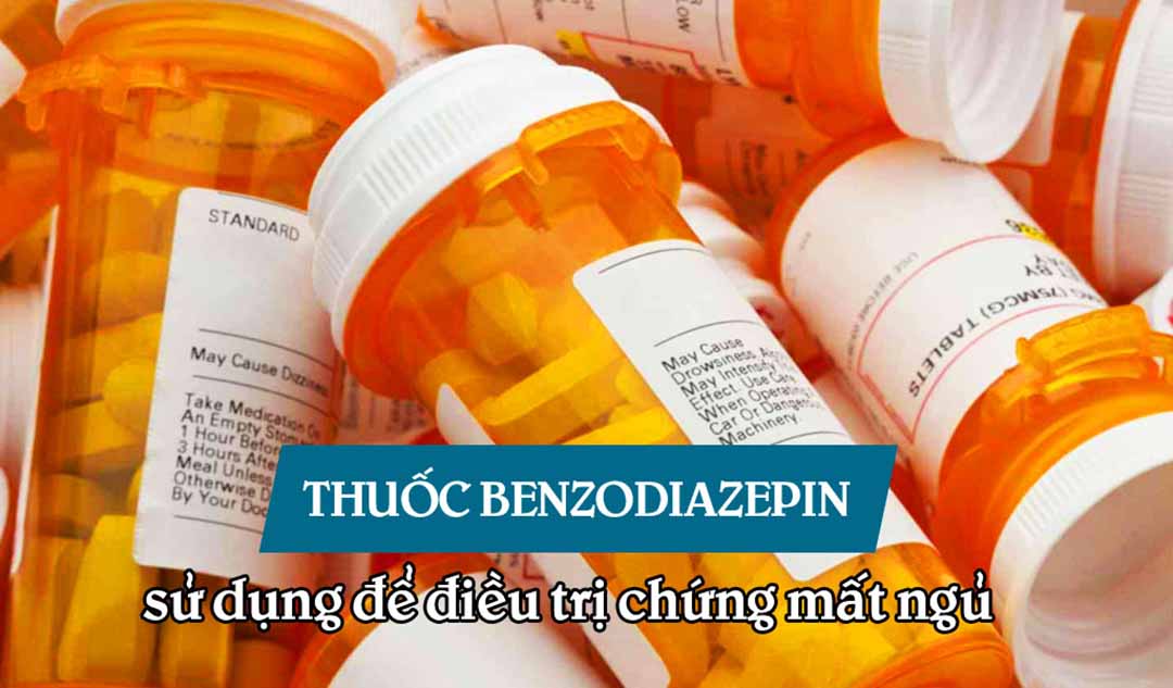 Thuốc benzodiazepin được sử dụng để điều trị chứng mất ngủ như thế nào?  