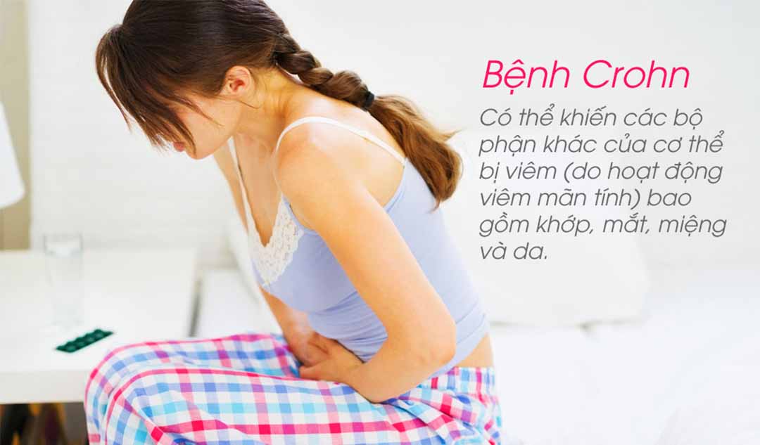 Bệnh Crohn gây ra tình trạng viêm như thế nào?