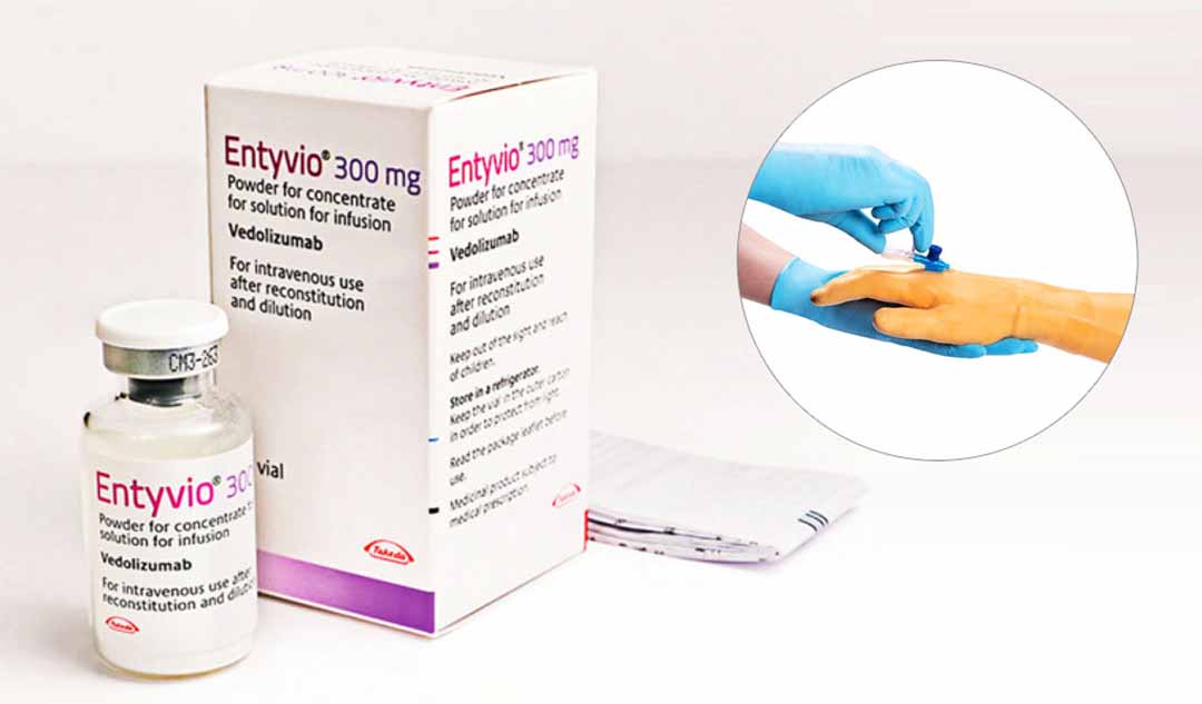 Vedolizumad (Entyvio) được sử dụng để điều trị bệnh Crohn như thế nào?