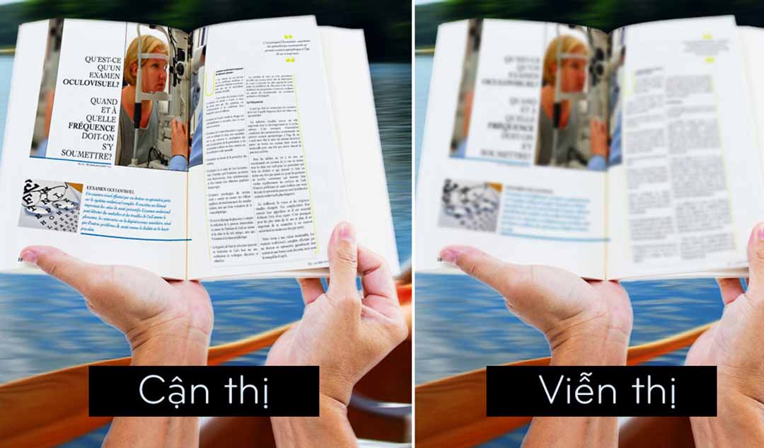 Cận thị và viễn thị sẽ như thế nào?