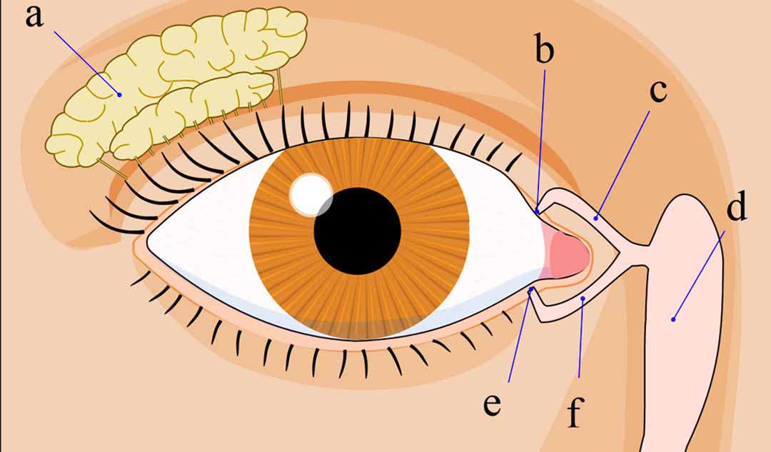 Điều gì xảy ra nếu bệnh tắc tuyến lệ không trở nên tốt hơn?