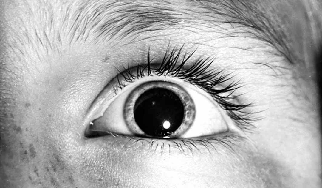 Nếu tôi có một vật bị mắc kẹt trong mắt, những loại thuốc mà bác sĩ của tôi sẽ sử dụng là gì?