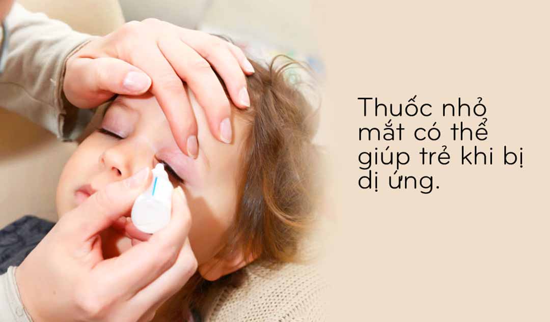 Thuốc nhỏ mắt có thể giúp trẻ em như thế nào?