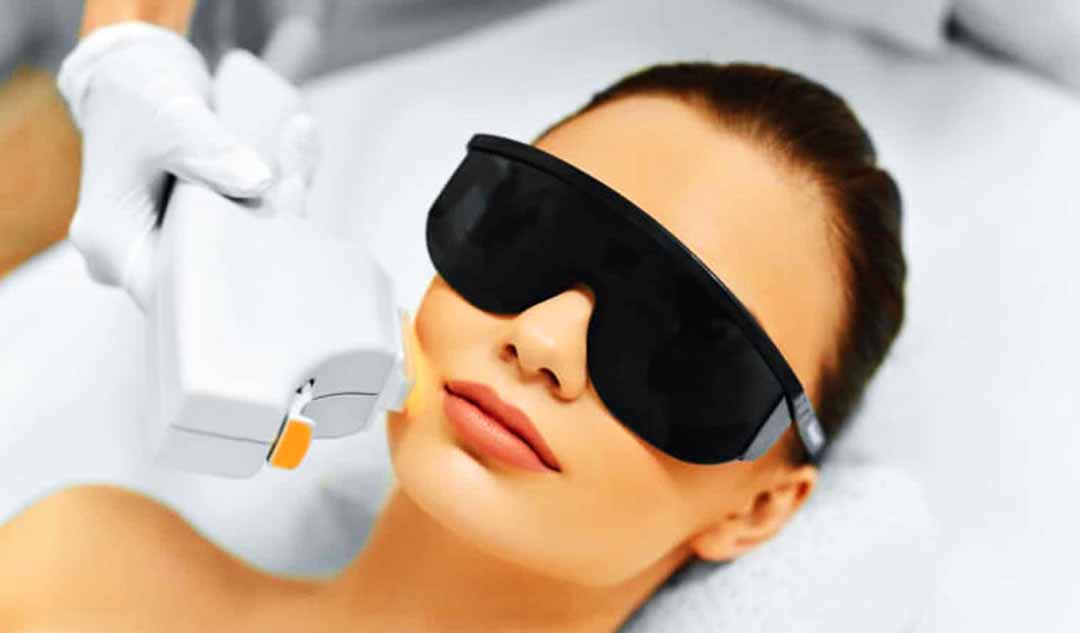 Biến chứng của tái tạo bề mặt da bằng tia laser là gì?