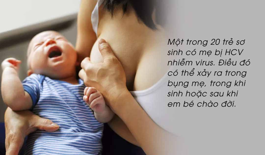 Viêm gan C (HCV) ảnh hưởng đến em bé như thế nào ?