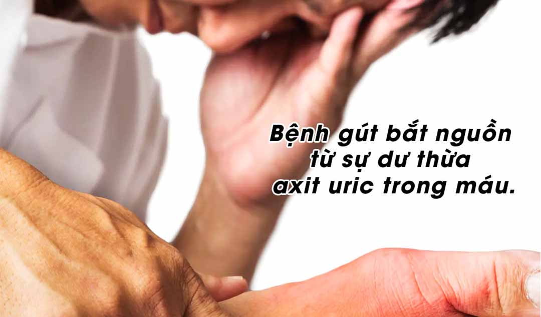 Nguyên nhân gây bệnh gút là gì ?