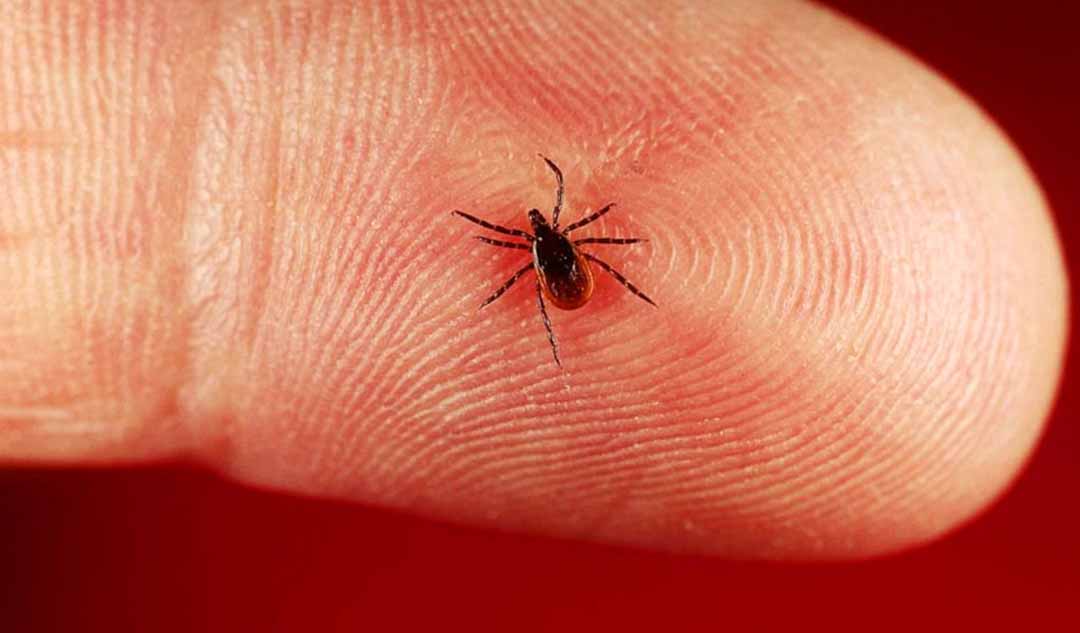 Nguyên nhân gây nên bệnh Lyme là gì ?