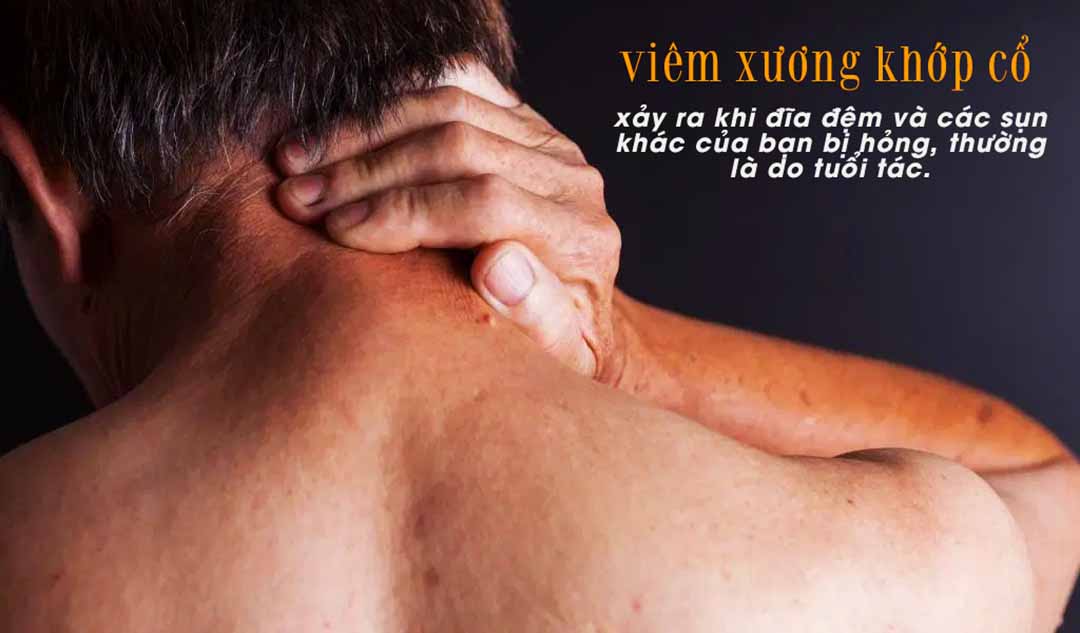 Nguyên nhân gây nên viêm xương khớp cổ (thoái hoá đốt sống cổ) là gì ?