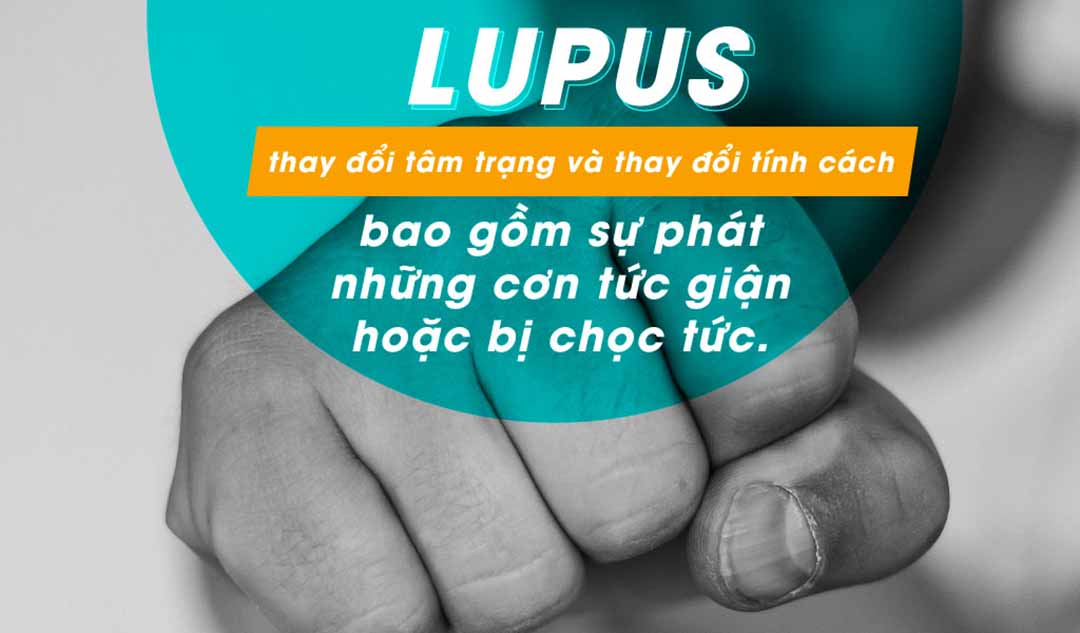 Lupus có thể dẫn đến sự thay đổi tâm trạng và thay đổi tính cách như thế nào?