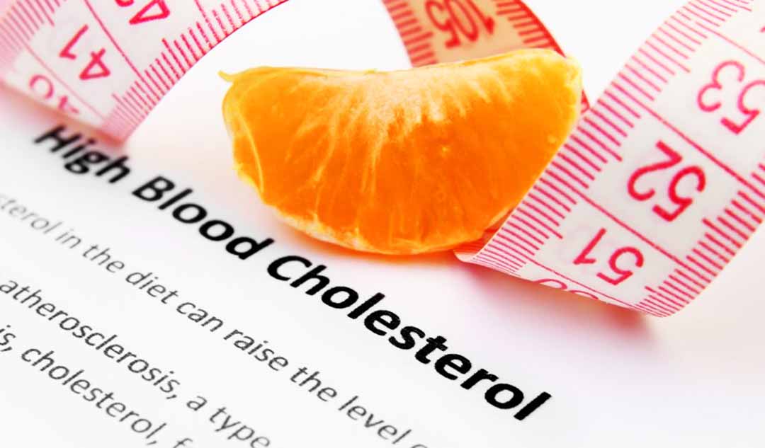 Các yếu tố nguy cơ nào có thể kiểm soát được cholesterol (một chất béo steroid trong máu) cao?