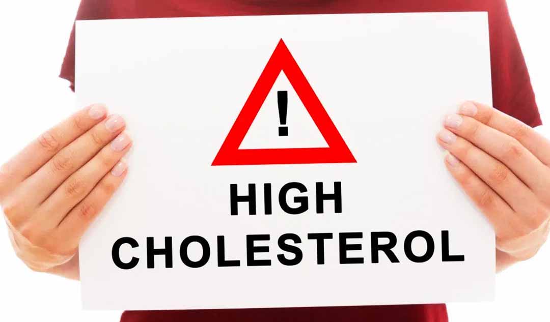 Cholesterol (là một chất béo steroid trong máu) cao liên quan đến những bệnh gì? 