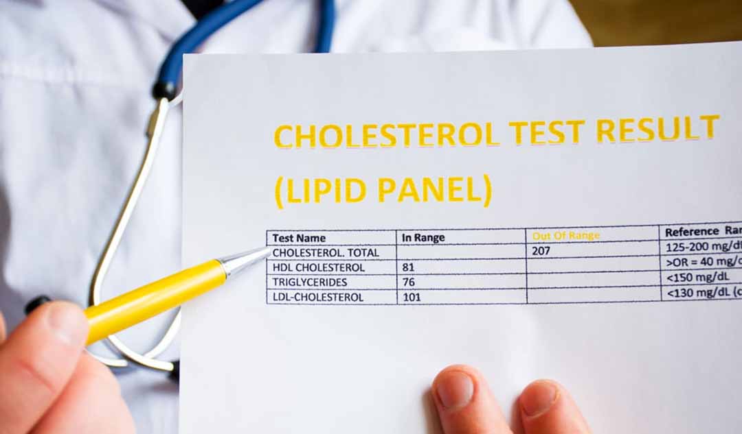 Kết quả xét nghiệm cholesterol của bạn có ý nghĩa gì?