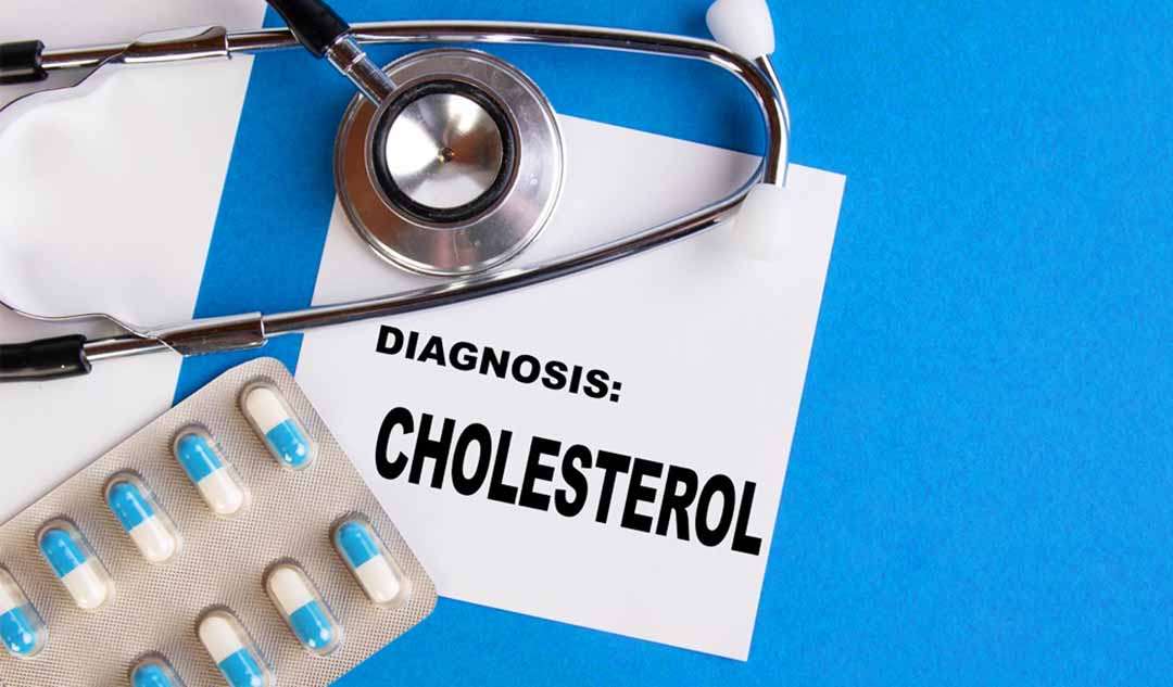 Khi nào bạn nên bắt đầu kiểm tra cholesterol?