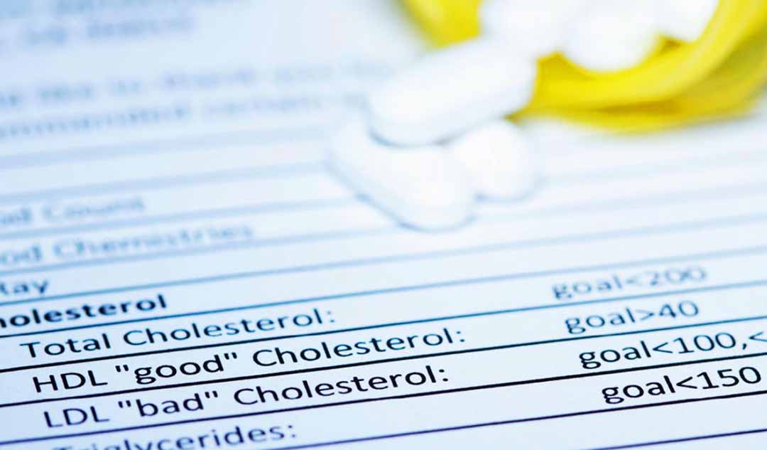 Làm thế nào để tìm ra chỉ số cholesterol của bạn? 