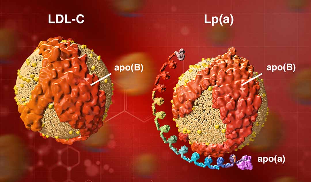 Lipoprotein là gì?