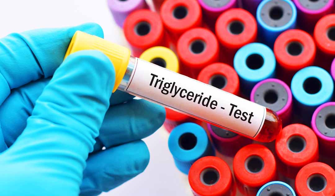 Mức triglyceride có ý nghĩa gì đối với bệnh tiểu đường?