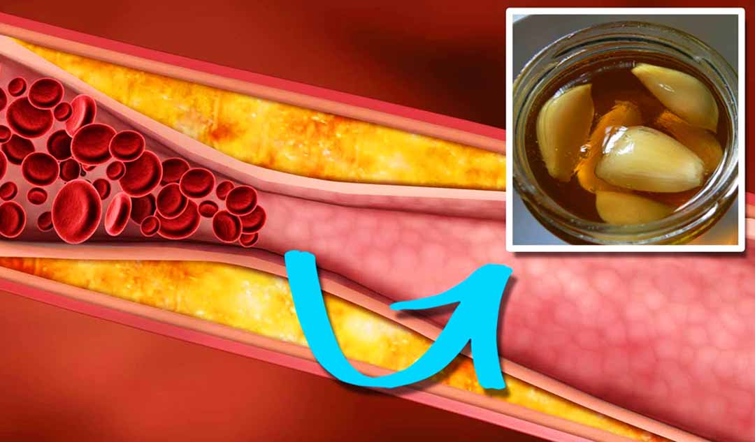 Những loại thuốc có thể làm giảm mức triglyceride cao?