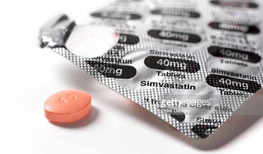 Tác dụng phụ của việc dùng statin để giảm cholesterol "xấu" (LDL) là gì?