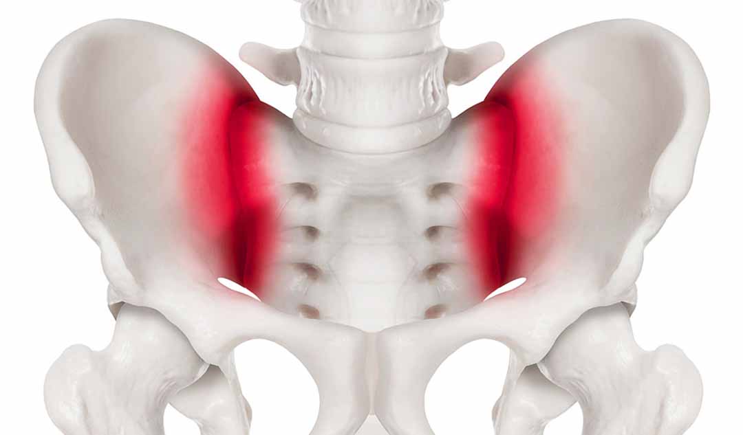 Cơn đau từ khớp SI (sacroiliac) sẽ có cảm giác như thế nào?