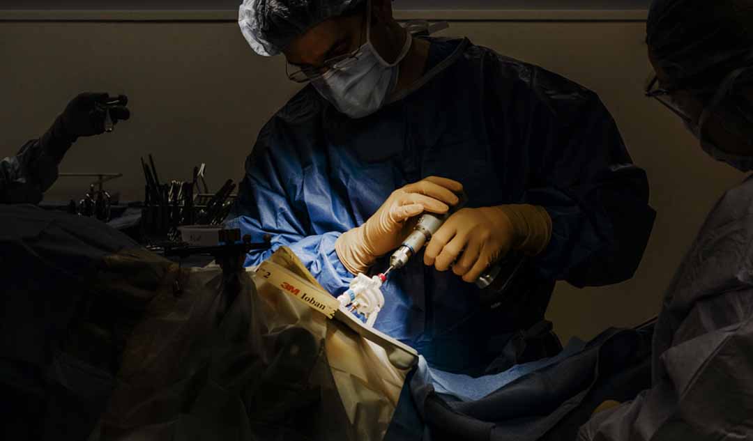 Phương pháp phẫu thuật cắt chức năng bán cầu não cho bệnh nhân động kinh là gì?
