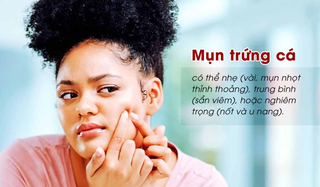 Mụn trứng cá là gì và nó có thể nghiêm trọng như thế nào?