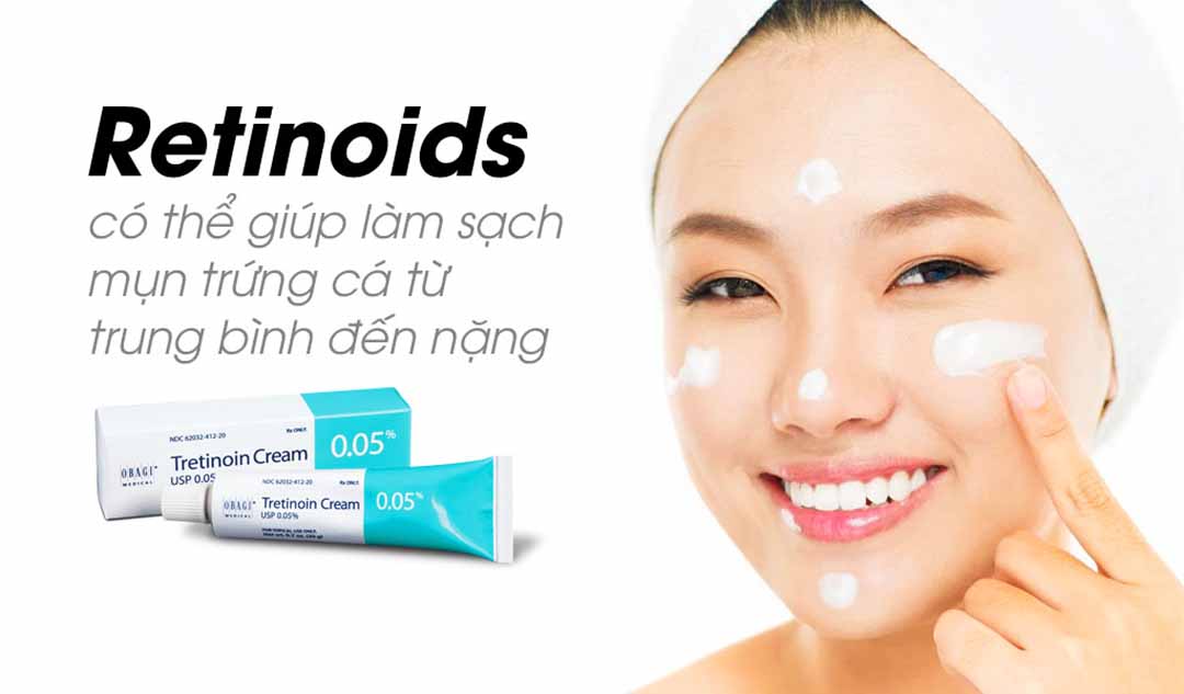 Retinoids được sử dụng để điều trị mụn trứng cá như thế nào?