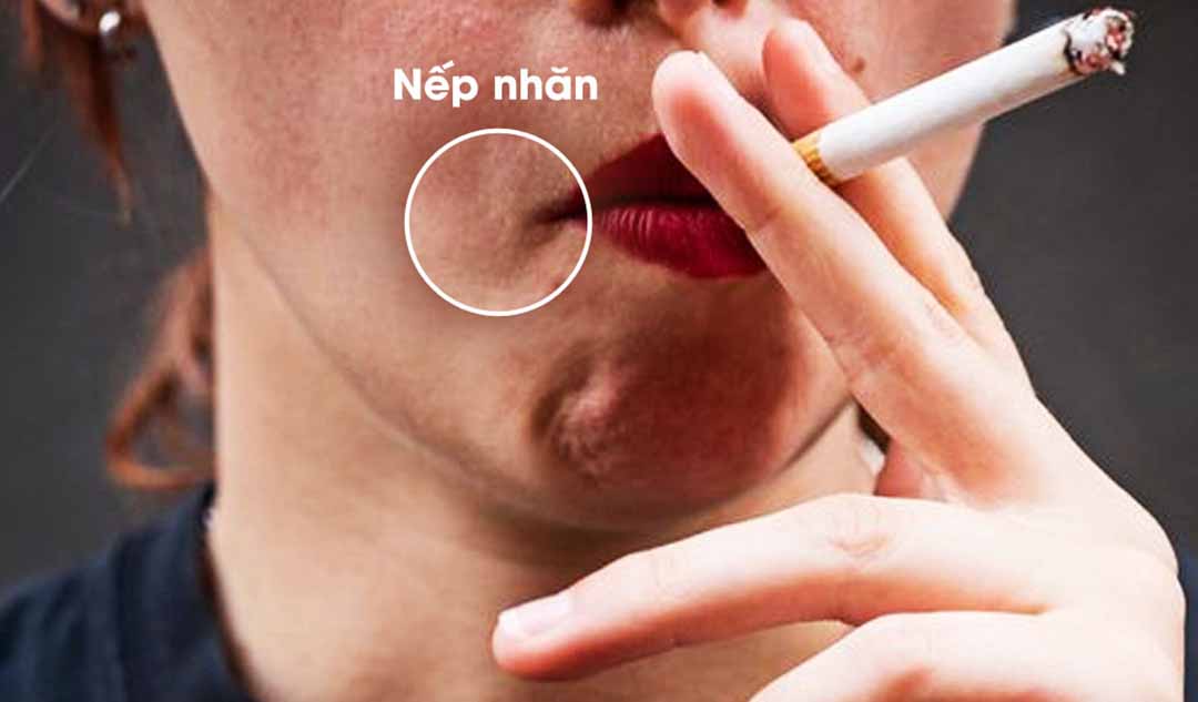 Làm thế nào để chống lại thói quen hút thuốc ảnh hưởng đến làn da của bạn?