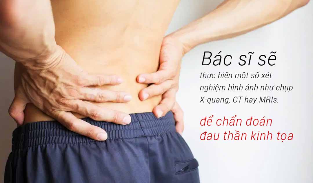 Bác sĩ sẽ xác định thế nào nếu bạn bị đau thần kinh tọa?