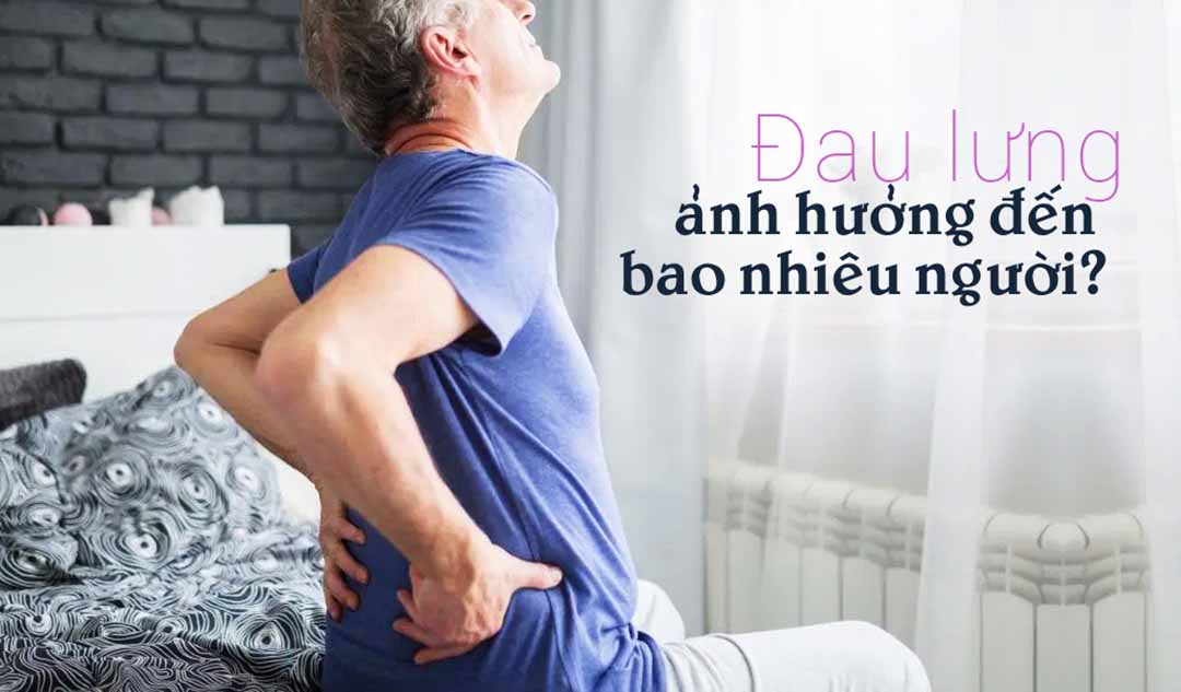 Đau lưng ảnh hưởng đến bao nhiêu người?