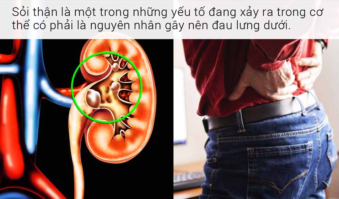 Liệu những yếu tố đang xảy ra trong cơ thể có phải là nguyên nhân gây nên đau lưng dưới?