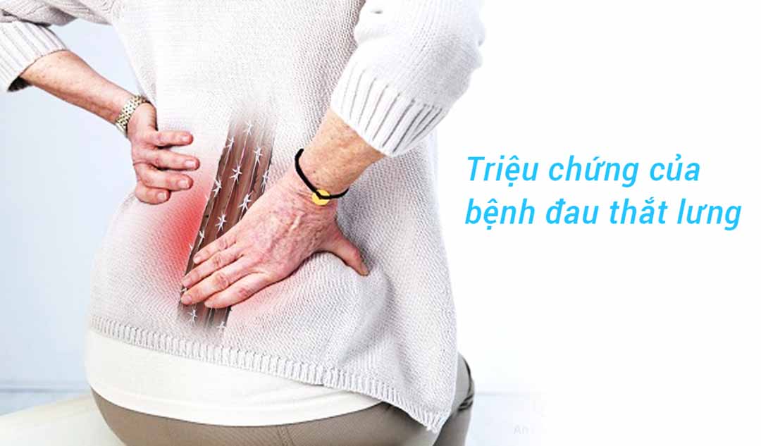 Triệu chứng của bệnh đau thắt lưng là gì?