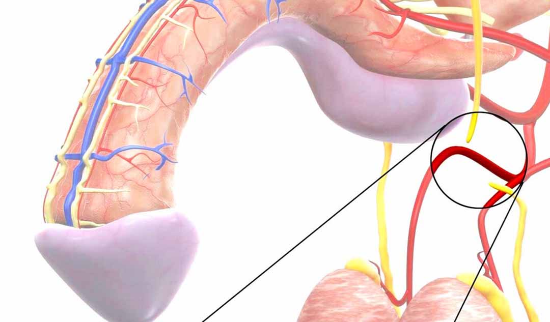  Hiệu quả của thắt ống dẫn tinh như thế nào?