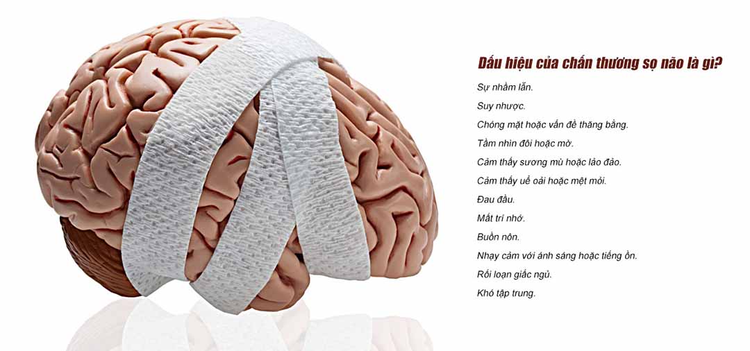 Dấu hiệu của chấn thương sọ não là gì?