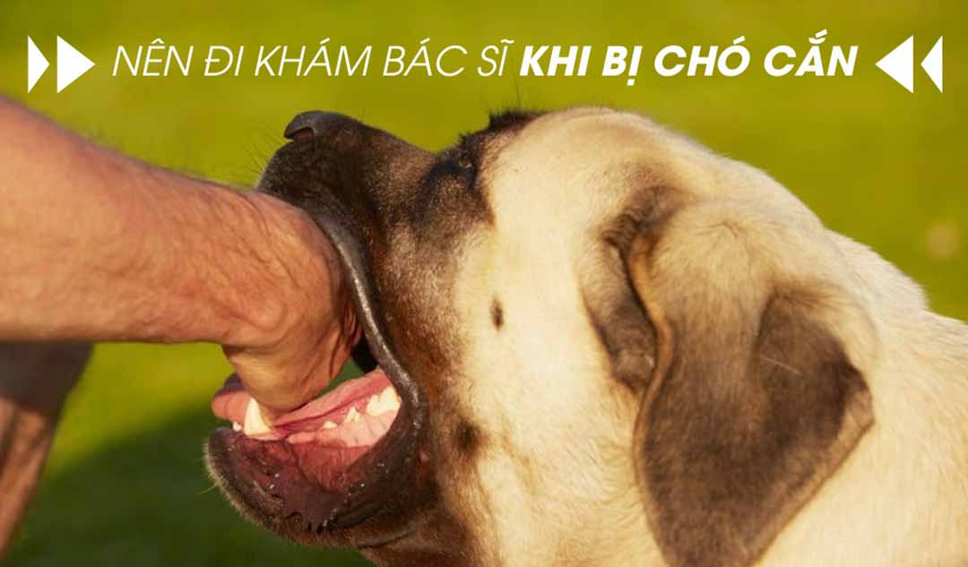 Bạn có nên đi khám bác sĩ khi bị chó cắn?