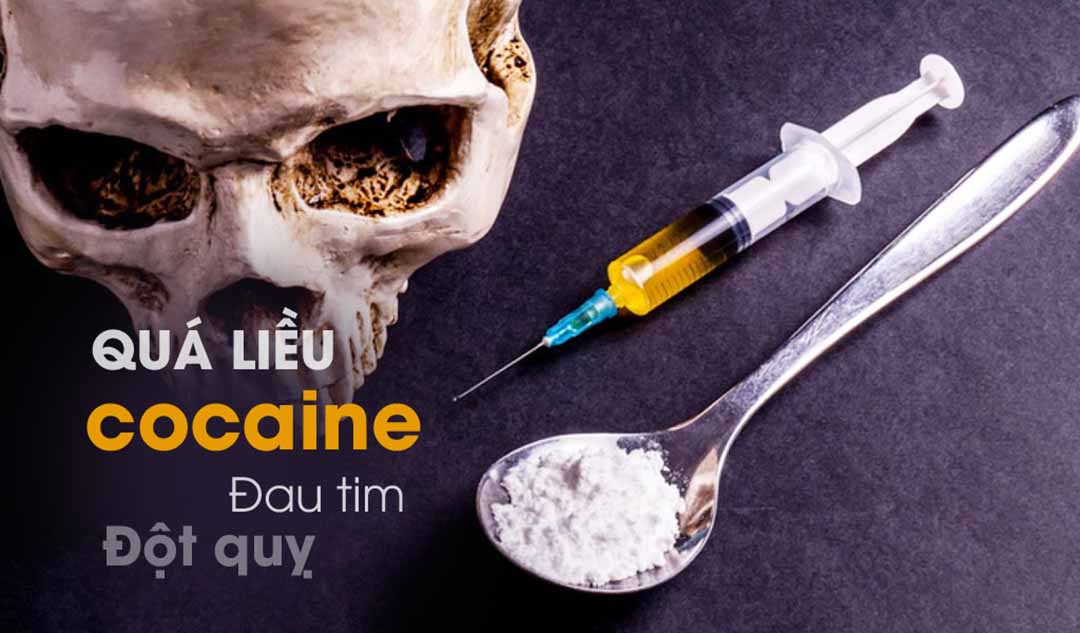 Quá liều cocaine có thể dẫn đến những gì?