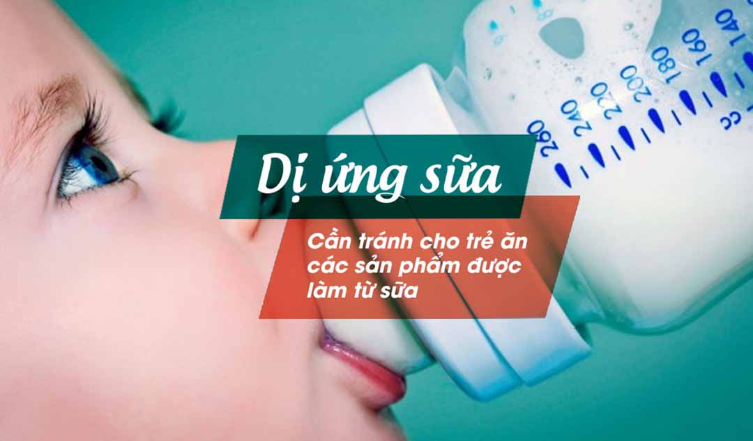 Con tôi bị dị ứng với sữa. Liệu tôi có cần cho cháu kiêng tất cả các sản phẩm của sữa không?