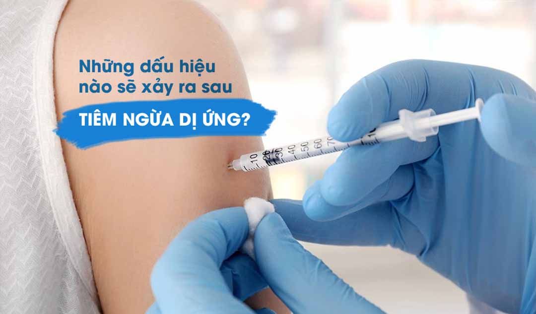 Những dấu hiệu nào sẽ xảy ra sau khi tiêm ngừa dị ứng?