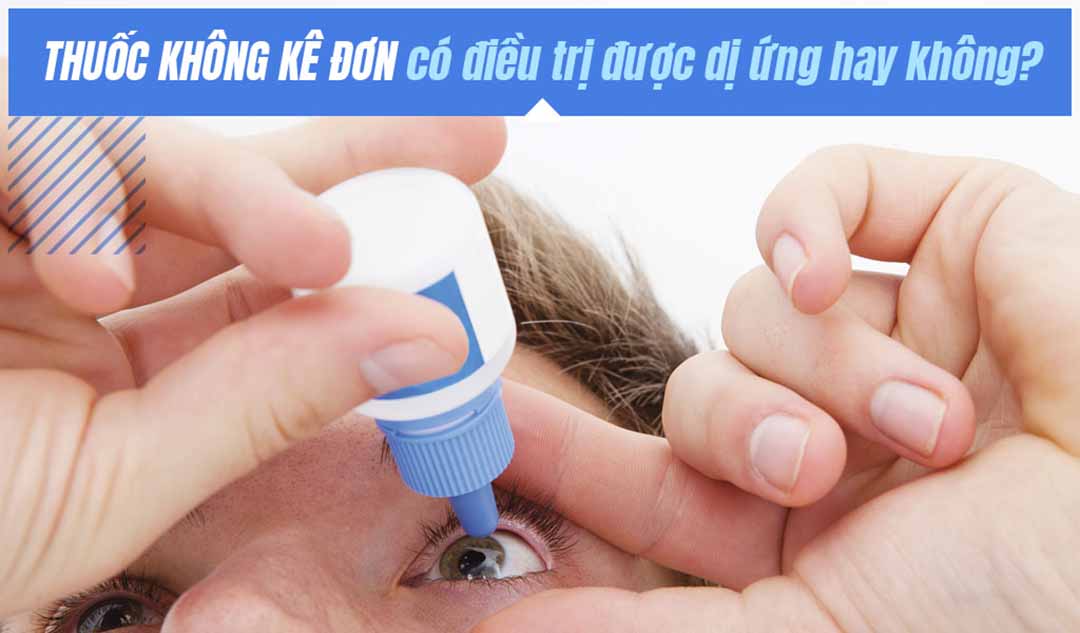 Thuốc không kê đơn có điều trị được dị ứng hay không?