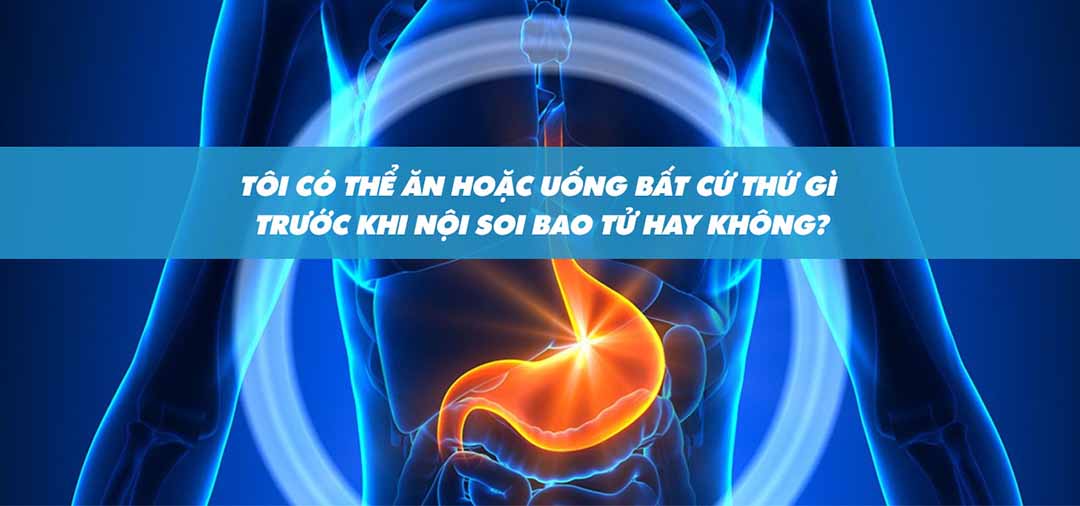  Tôi có thể ăn hoặc uống bất cứ thứ gì trước khi nội soi bao tử hay không?