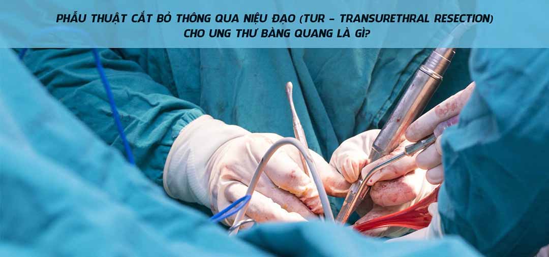 Phẫu thuật cắt bỏ thông qua niệu đạo (TUR - transurethral resection) cho ung thư bàng quang là gì?