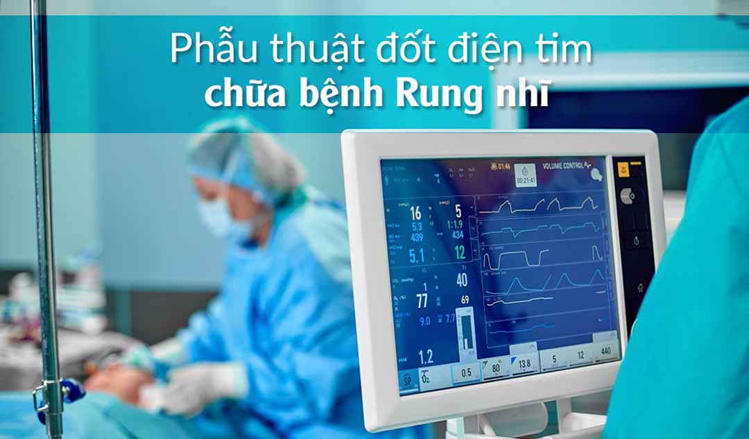 Phẫu thuật Đốt điện tim chữa bệnh Rung nhĩ là gì và có tác dụng như thế nào?