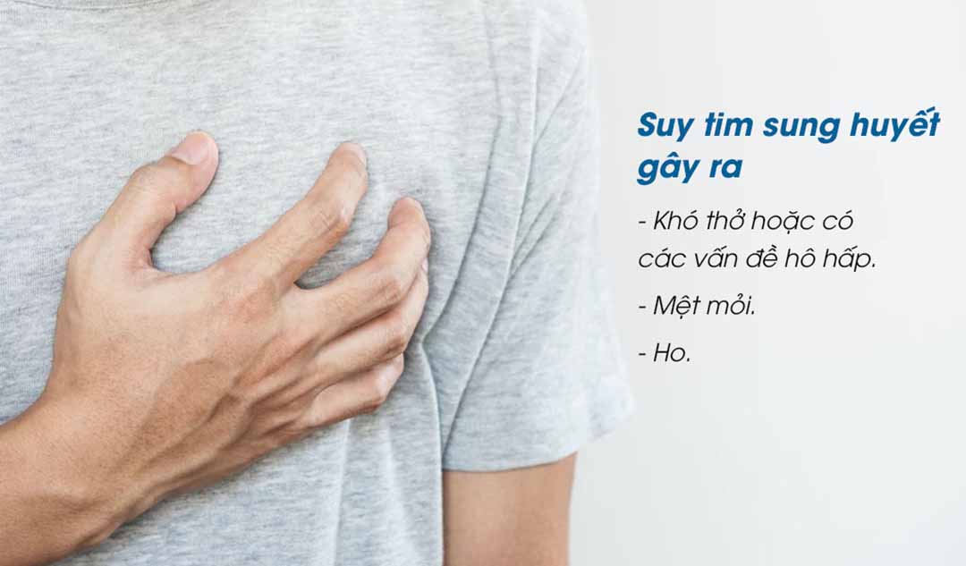 Làm thế nào để người bệnh biết được hiện tượng sưng phồng chân là do suy tim sung huyết gây ra?