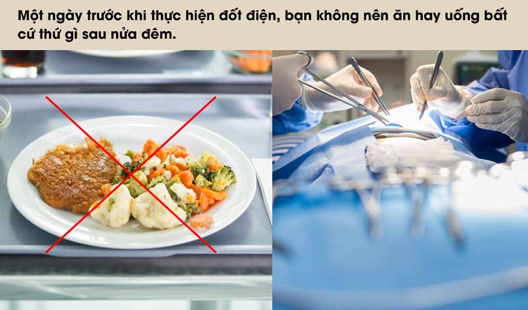 Trước khi thực hiện Đốt điện chữa bệnh Rung nhĩ thì tôi có thể ăn hoặc uống được không?