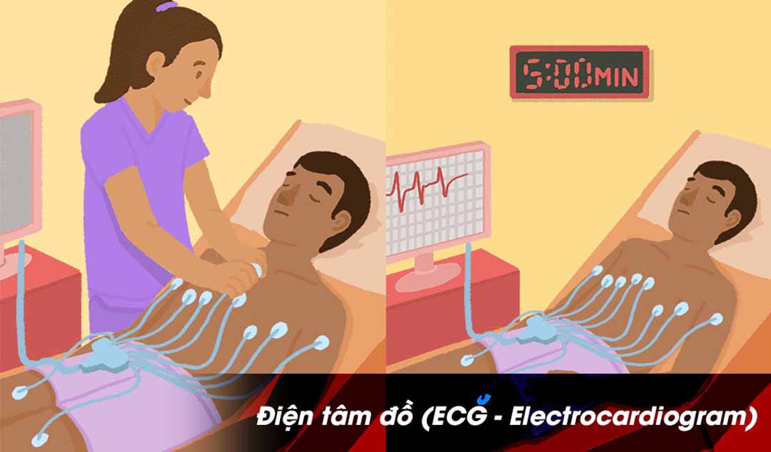 Bệnh Cuồng nhĩ được chẩn đoán bằng những bài kiểm tra nào?