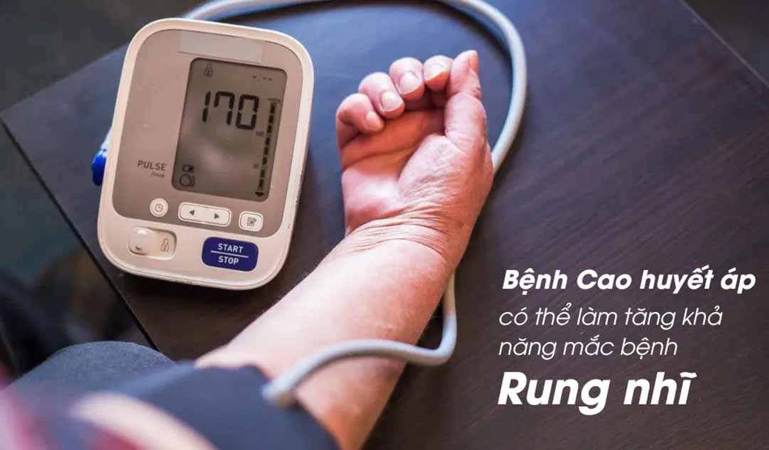 Các tình trạng y tế nào khác có thể làm tăng khả năng mắc bệnh Rung nhĩ?