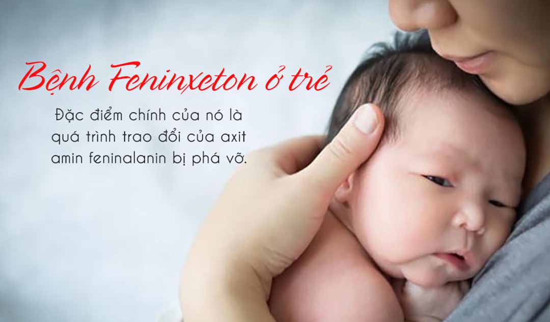 Bệnh Feninxeton là gì?